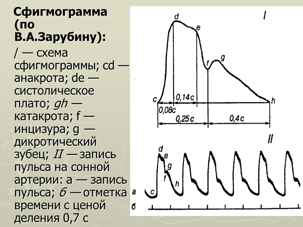Сфигмограмма (по В.А.Зарубину): / — схема сфигмограммы; cd — анакрота; de — систолическое плато;